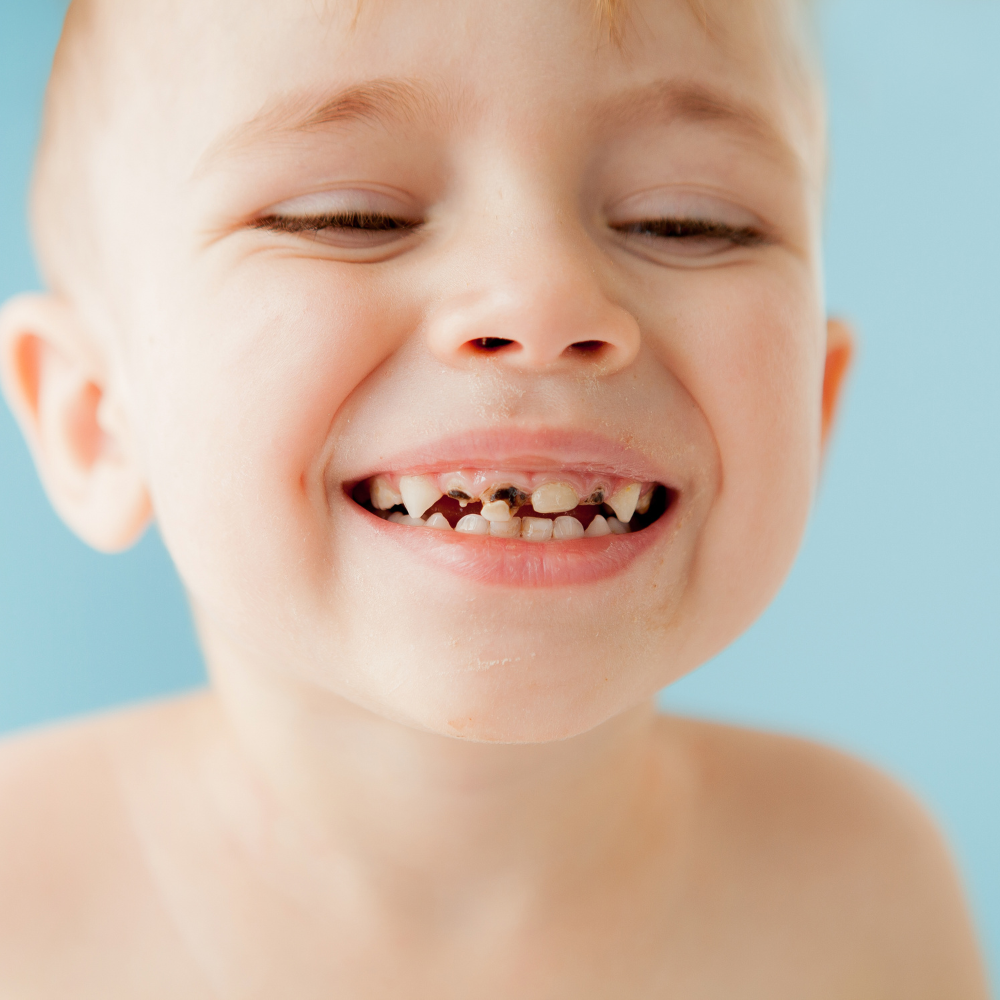 Why Is My Child’s Permanent Teeth Growing Behind the Baby Teeth
