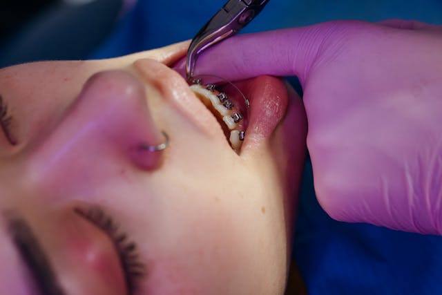 Benefits of Why All Comprehensive Orthodontic Treatment Should Be Completed by a Board Certified Orthodontist